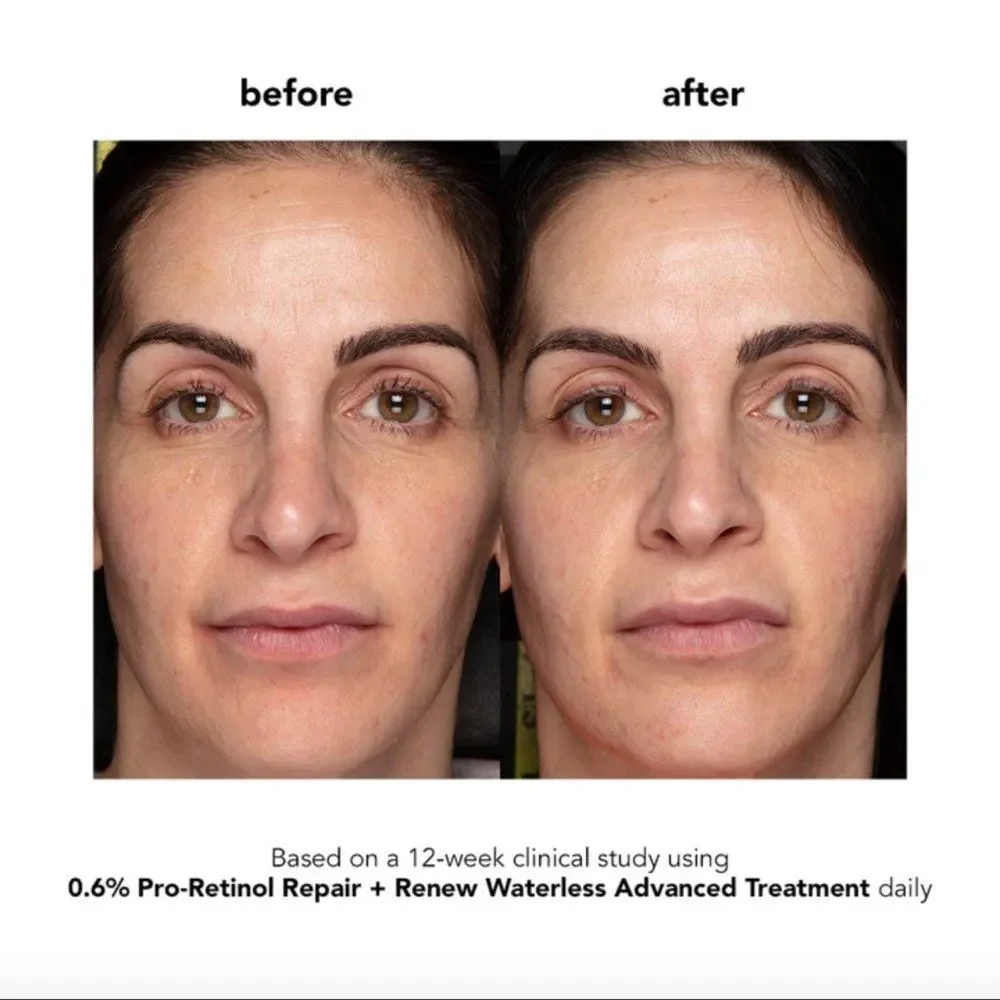 NEW Boscia 0.6% Pro-Retinol Repair + Renew Waterless Advanced Treatment
